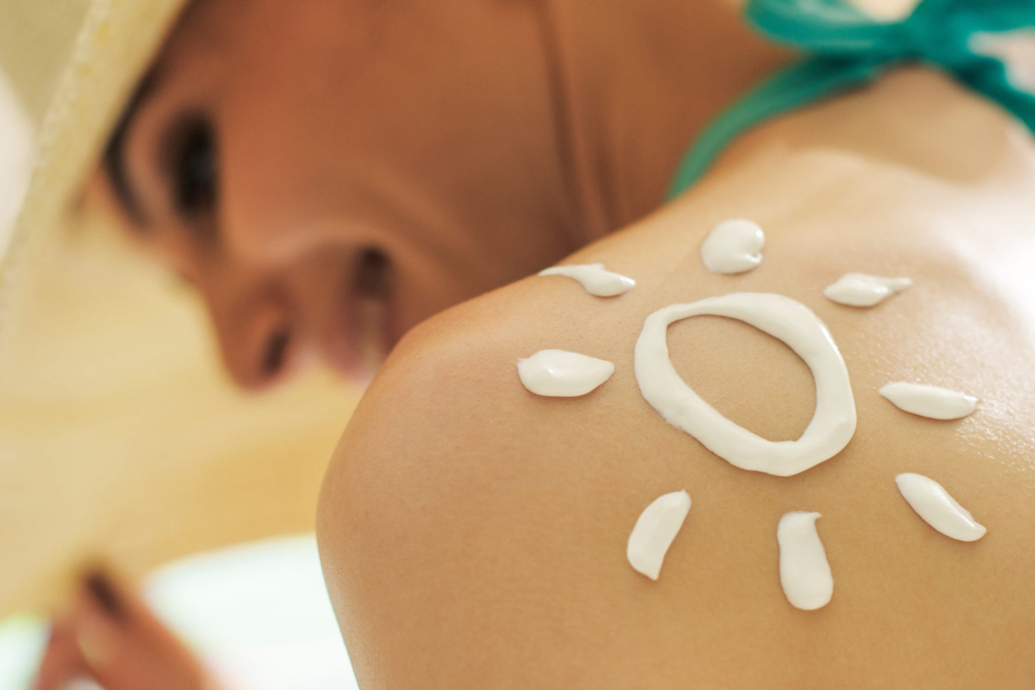 Heat Rash & Bacne Ruining Your Summer? Try This Simple Natural Routine