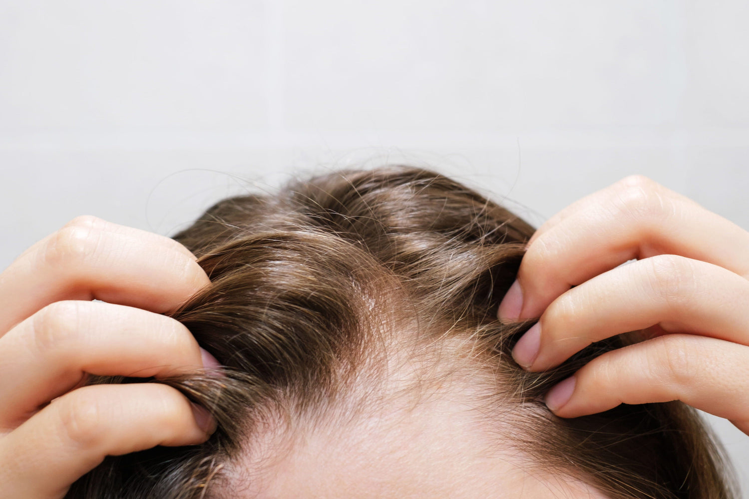 The Winter Scalp Survival Guide: Natural Ways to Soothe Dryness and Flakes